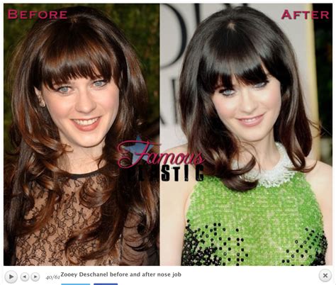 Zooey Deschanels Plastic Surgery: Nose Job, Lip。